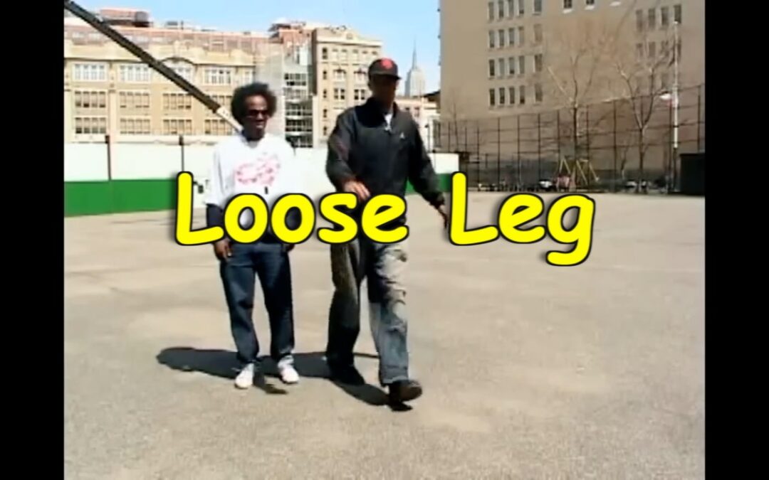 loose leg